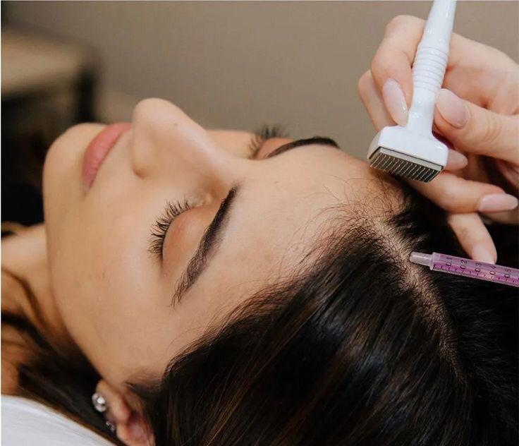 Derma Stamp Roller – 140 Titanium Microneedles for Skin.